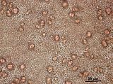 8 – Cellule corticali e tetrasporocisti in visione superficiale